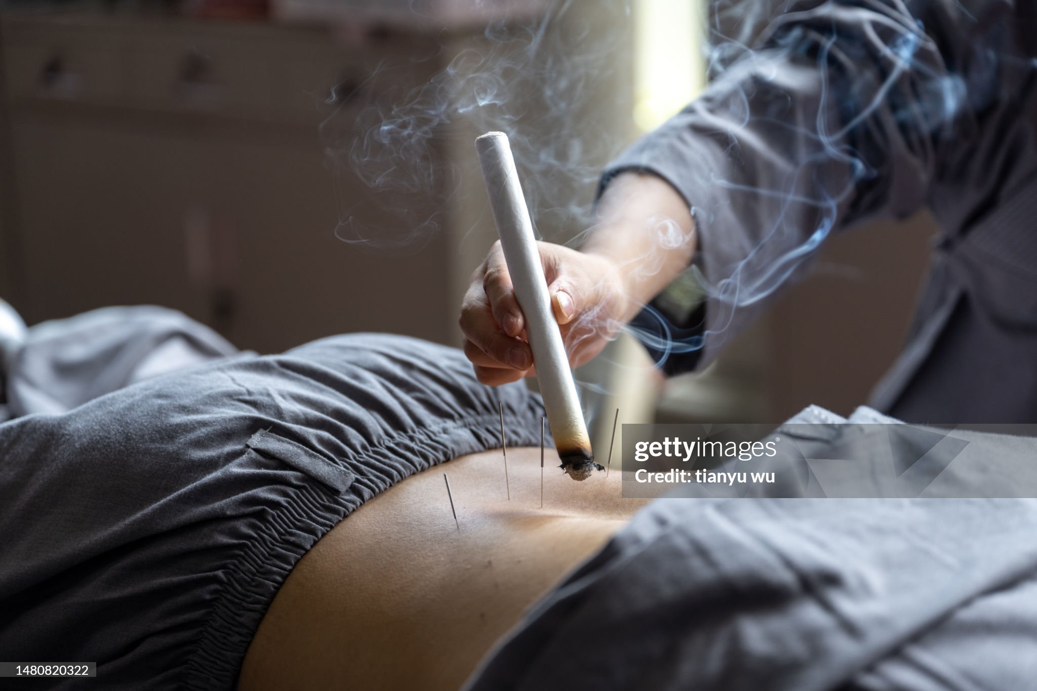 Acupuncture clinical care